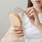 Combining PRP with Other Hair Loss Treatments