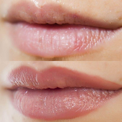 Permanent Makeup Lips Color, Liner - Cupids Bow Tattooed Fuller Lips