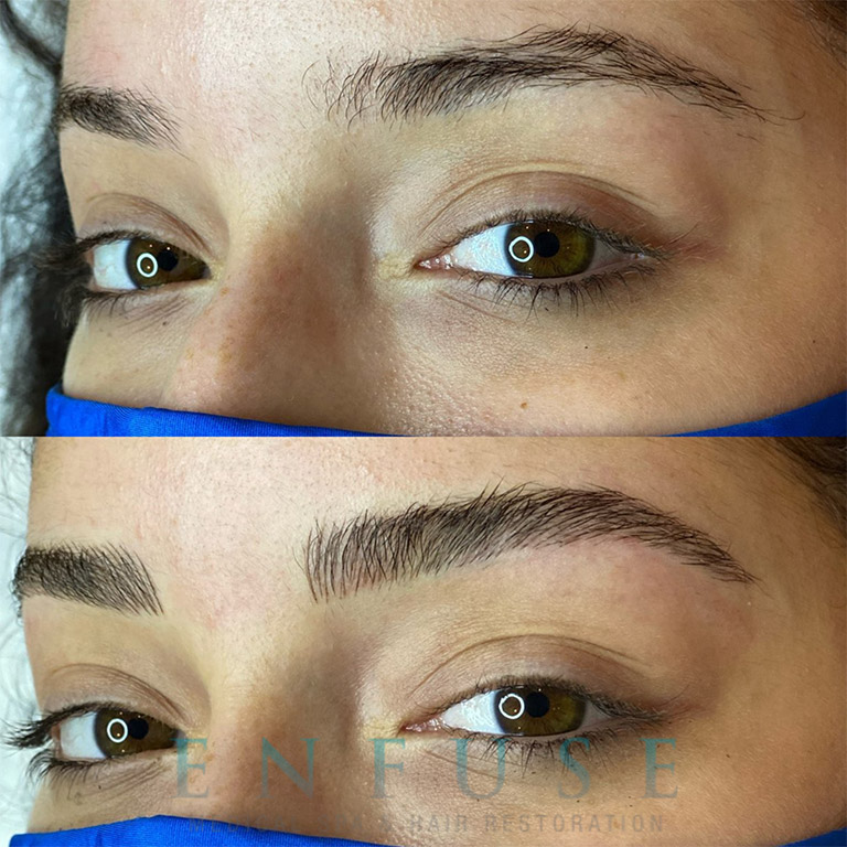 3D Brow Microblading Before & After