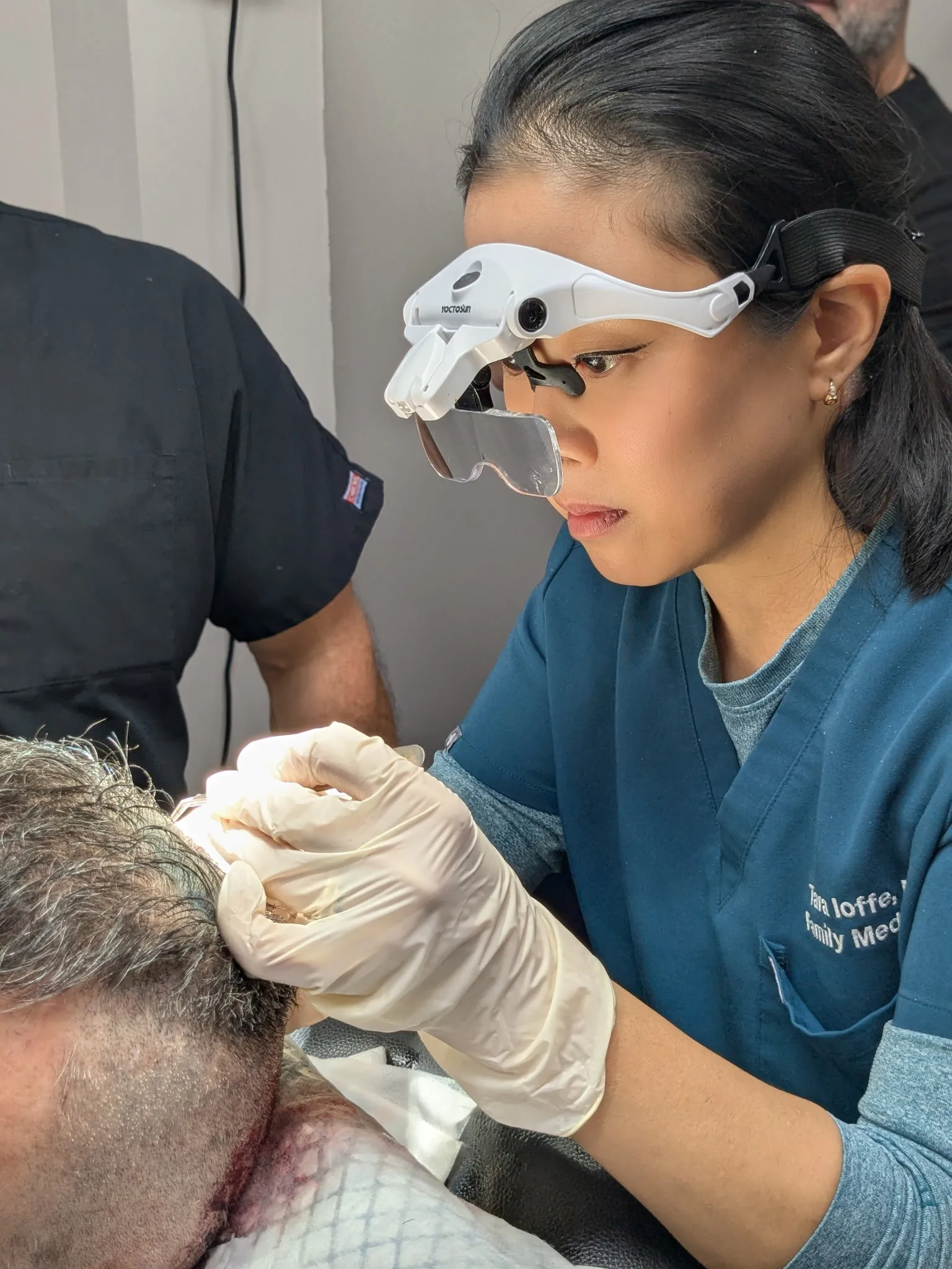 Tara doing Hair Restoration - FUE Transplant